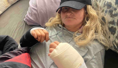 San Francisco woman who narrowly survived dog attack relives the horror: ‘kept hearing the crunching sound’