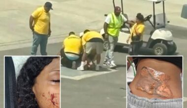 Bakersfield girl, 14, left with horrific injuries after security pinned her on scorching 'electric' plate