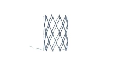 Miller Children’s & Women’s Hospital performs first Minima Stent procedure for infants with congenital heart conditions • Brand stories
