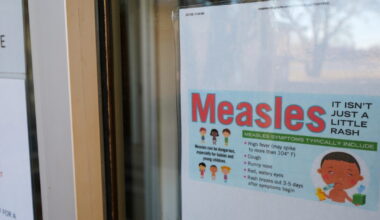 CDPH notifies public of possible measles exposure related to train, bus rider