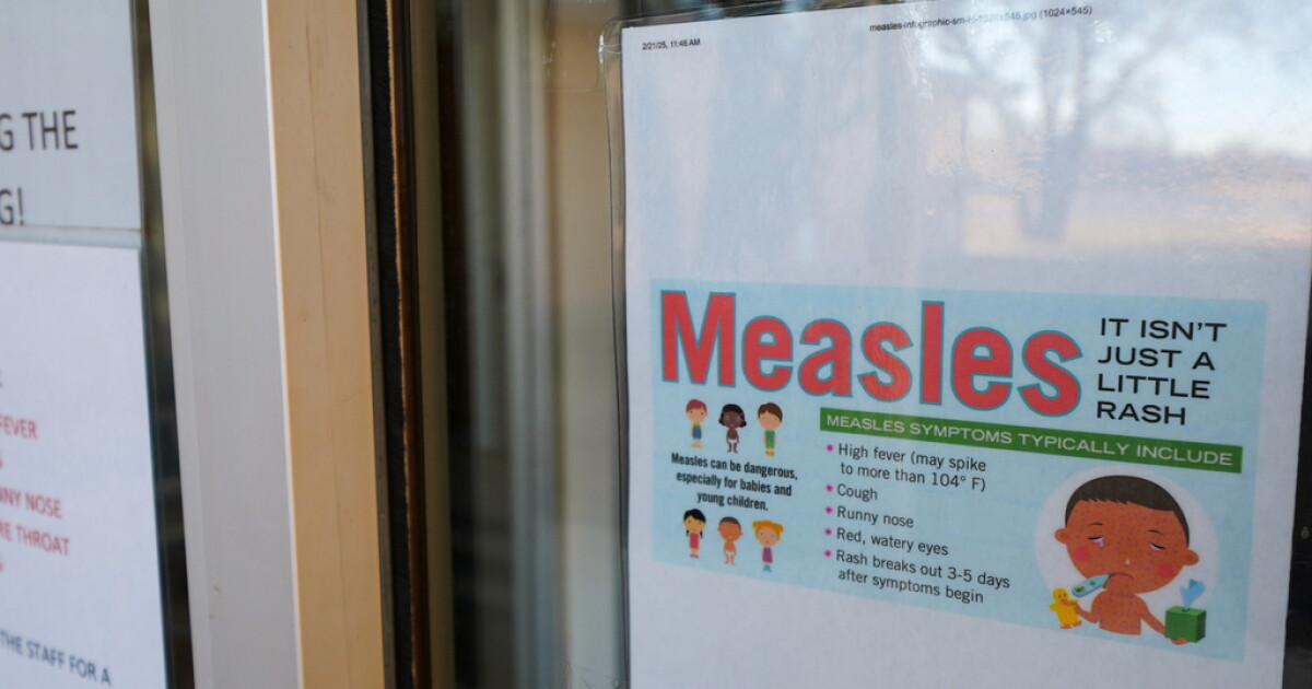 CDPH notifies public of possible measles exposure related to train, bus rider