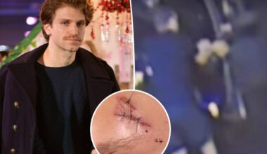 'Pretty Little Liars' star Keegan Allen reveals stitches following armed robbery in LA