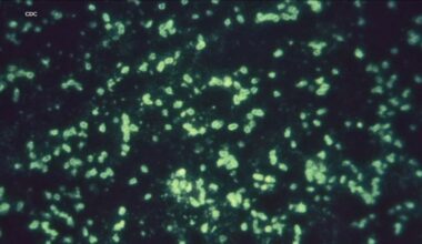 Russian lab death in Siberia sparks plague fears, but UCSF experts say there's no need to panic and 'it's not another COVID'