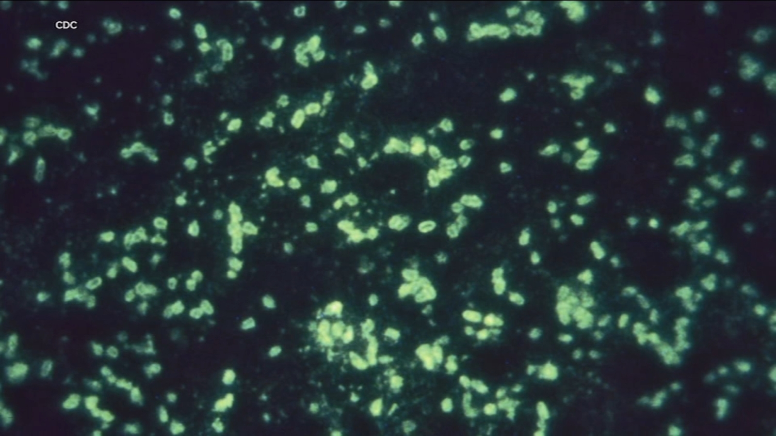 Russian lab death in Siberia sparks plague fears, but UCSF experts say there's no need to panic and 'it's not another COVID'
