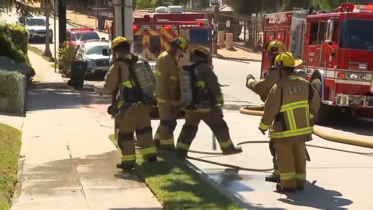 4 firefighters injured in Silver Lake house fire – NBC Los Angeles