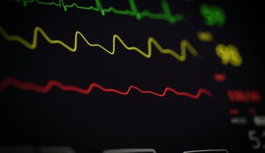 heart monitor