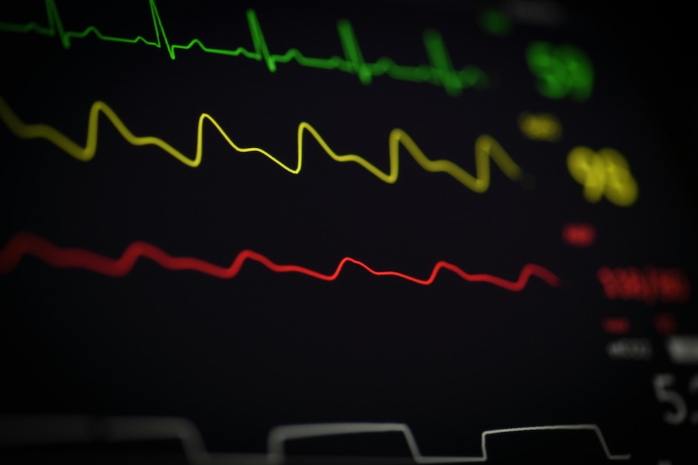 heart monitor