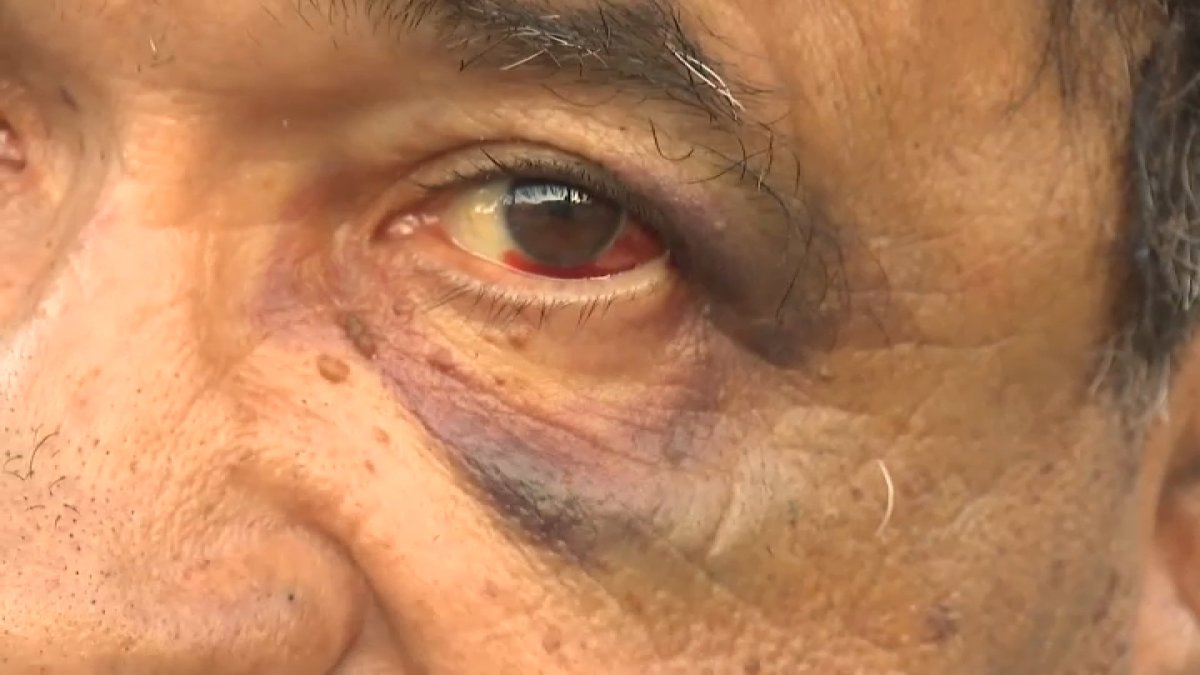 Group of 6 attack retired teacher in Hollywood in broad daylight – NBC Los Angeles