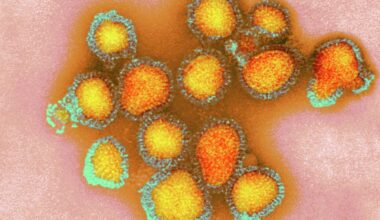 'Game on': Bay Area now epicenter of California flu cases
