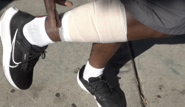 La Mesa handyman nearly loses leg to dog attack while helping homeless