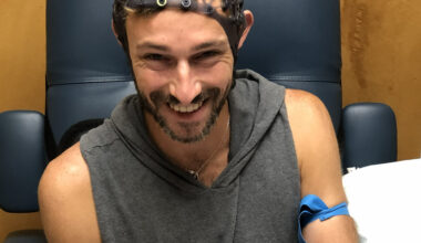 Brain Amyloid Flow Scan - Florida Weekly