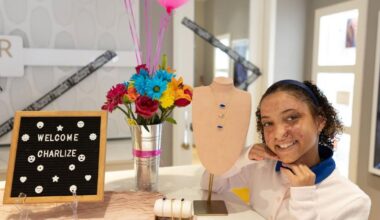 Burn survivor, 10, designs jewelry line for hospital that saved her | Seminole