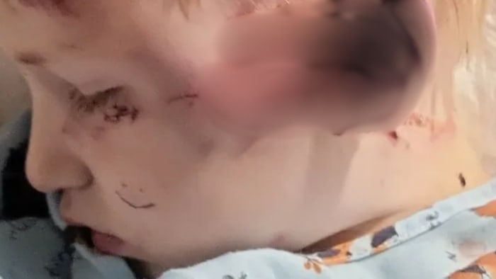 Family asks for help after 4-year-old boy loses his ear in Jacksonville dog attack