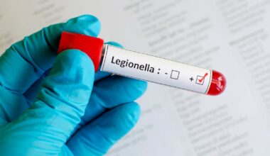 100 Confirmed Legionnaires’ Disease Cases In Orange County