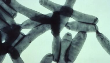 Orange County leads the state in Legionnaires' disease cases