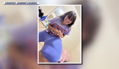 Rare condition forces St. Petersburg doctors to amputate teen's leg