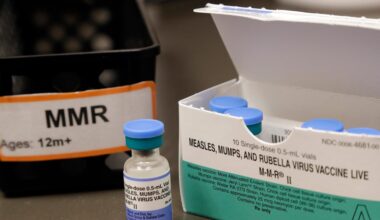 Measles cases reported in Florida, including 2 in the Tampa Bay area: What to know