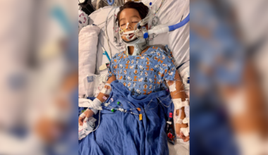 Estero boy recovers after drunk driver crash; family thanks community | Lee County