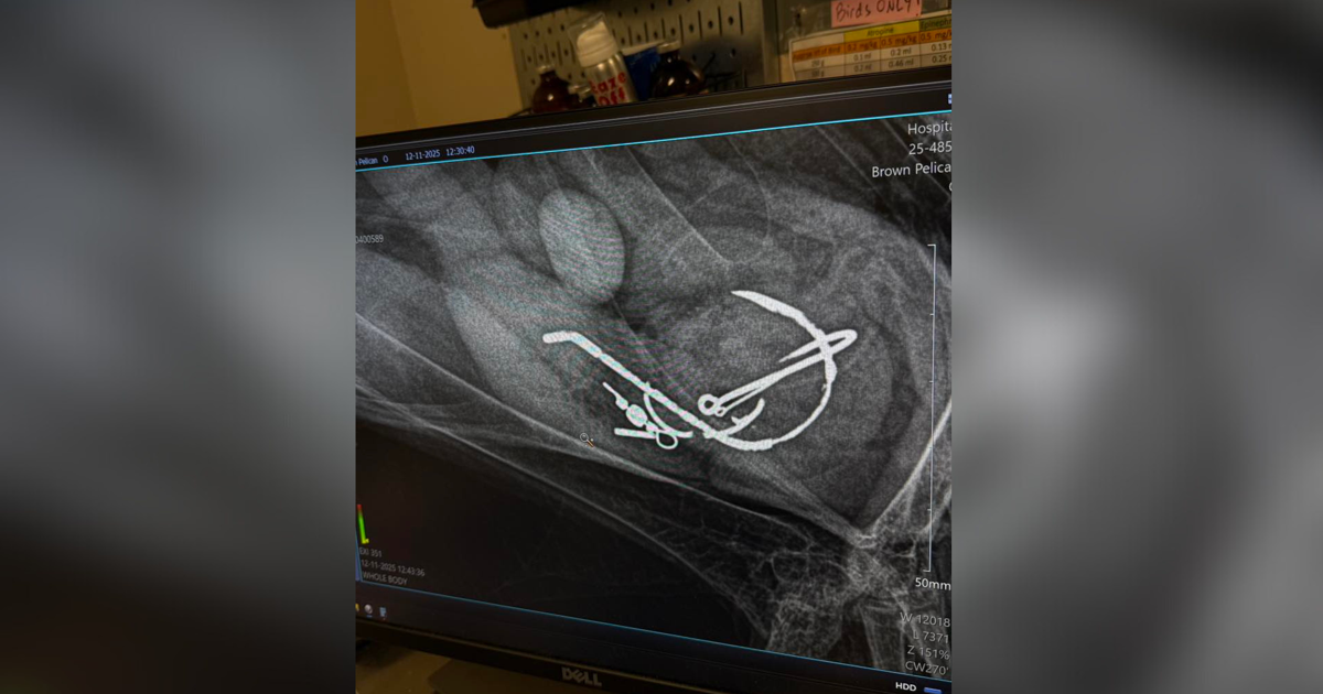 Sanibel wildlife clinic rescues pelican from swallowed hooks | Lee County