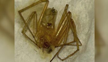 Florida woman says repeated spider bites inside her apartment led to toe amputation