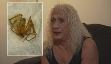 Woman sues Largo apartment management, claims spider bites led to toe amputations