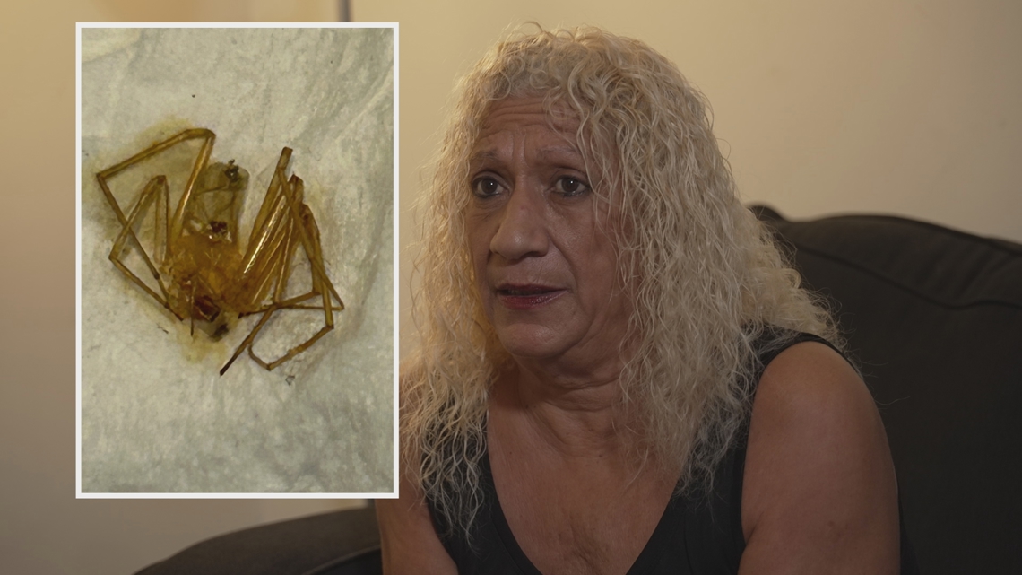 Woman sues Largo apartment management, claims spider bites led to toe amputations