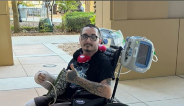 Jacksonville man who lost leg in Volusia County hit-and-run speaks – Action News Jax