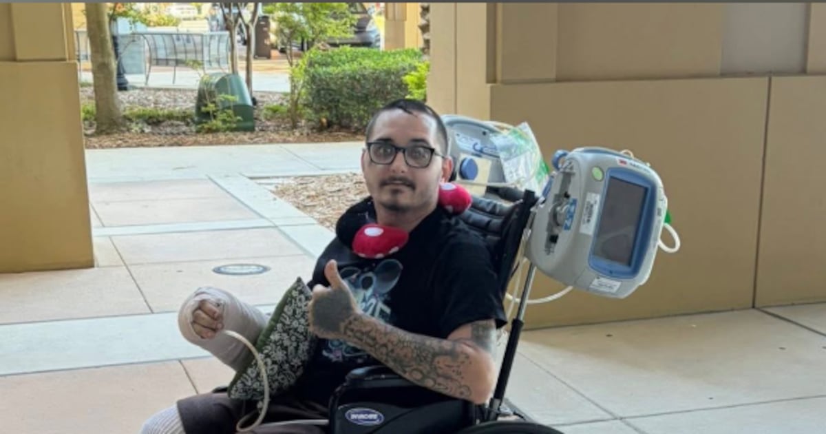 Jacksonville man who lost leg in Volusia County hit-and-run speaks – Action News Jax