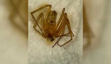 Florida woman suffers spider bites, toe amputation