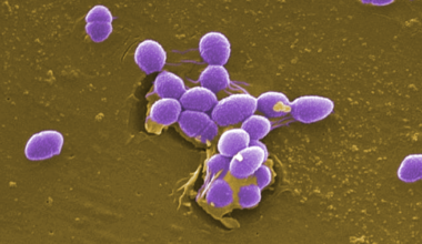 Lee County health officials warn of intestinal bacteria in the water at Lynn Hall Memorial Beach