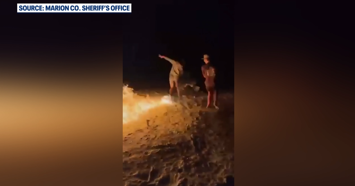 Florida teen facing felony battery charge after setting friend on fire, deputies say