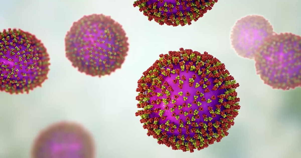 Measles case confirmed at St. Pete Catholic High School