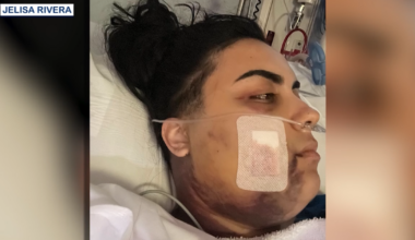 Florida man facing felony charges after shooting childhood friend in face at Orlando Wawa, deputies say