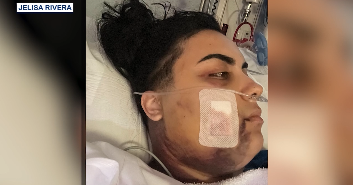 Florida man facing felony charges after shooting childhood friend in face at Orlando Wawa, deputies say