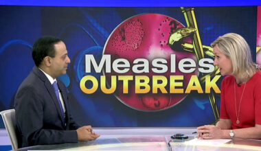 Jacksonville chief health officer explains measles symptoms amid rising cases, says virus is highly contagious