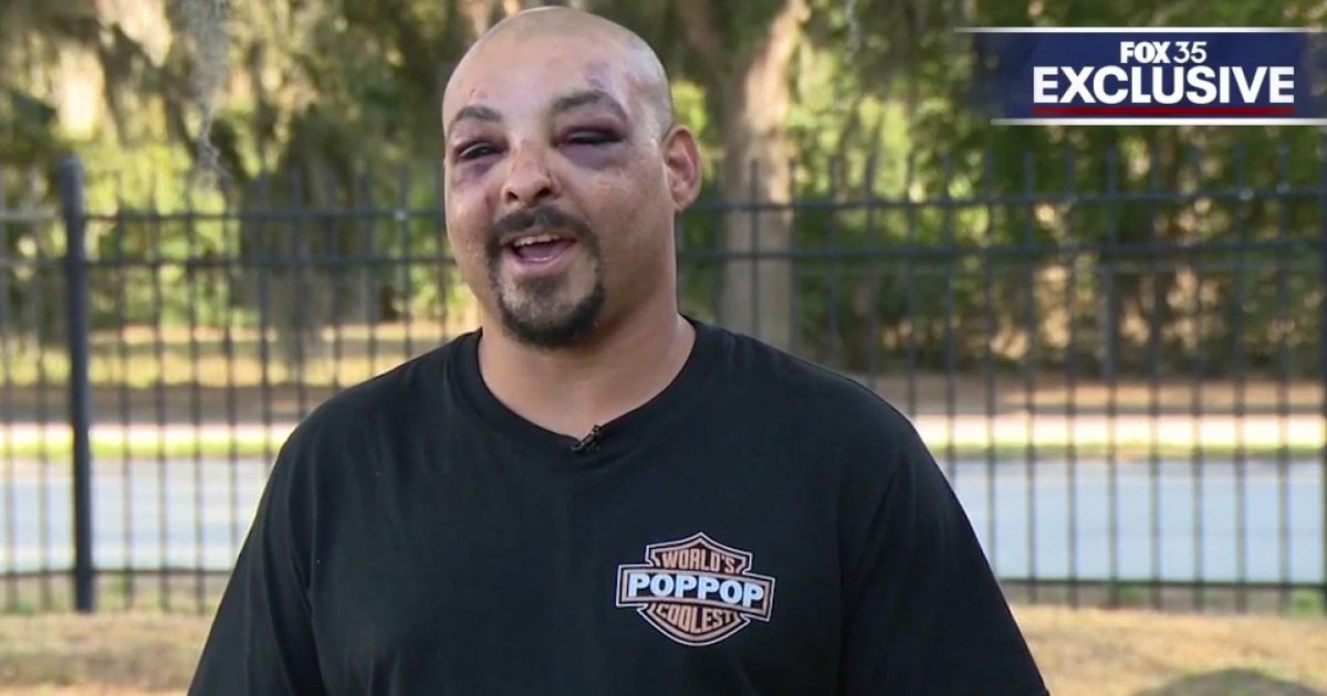 Army veteran injured in 4-on-1 assault at downtown Orlando smoke shop