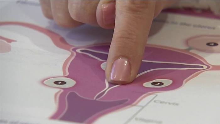 Jacksonville woman’s severe ovarian cysts took 10 years to be correctly diagnosed
