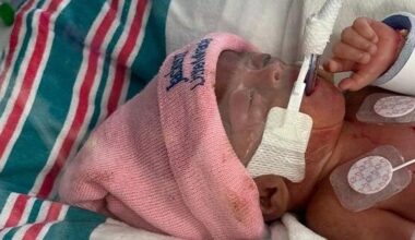 Baby born with complete heart block and rare fetal condition saved at Holtz Children’s Hospital | Health Wellness