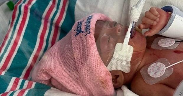 Baby born with complete heart block and rare fetal condition saved at Holtz Children’s Hospital | Health Wellness