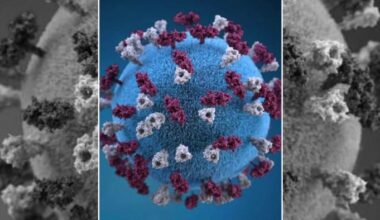 Florida Department of Health confirms sixth measles case in Duval County in 2026