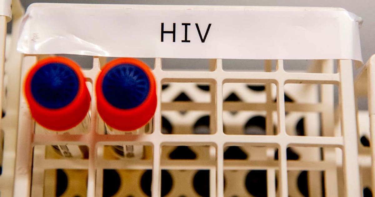 New Florida rule could restrict HIV medication access