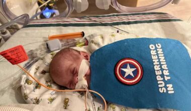 Cape Coral baby defies odds with miraculous recovery from health challenges