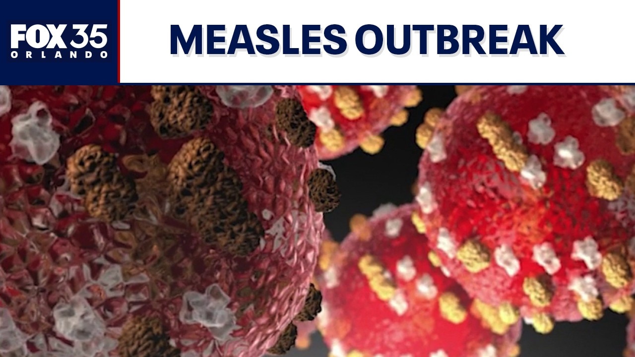 Concerning outbreak of measles reported in SW Florida