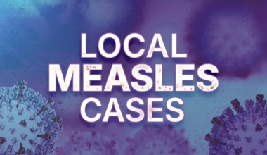 Fifth measles case confirmed in Duval County ‘outbreak’ – Action News Jax