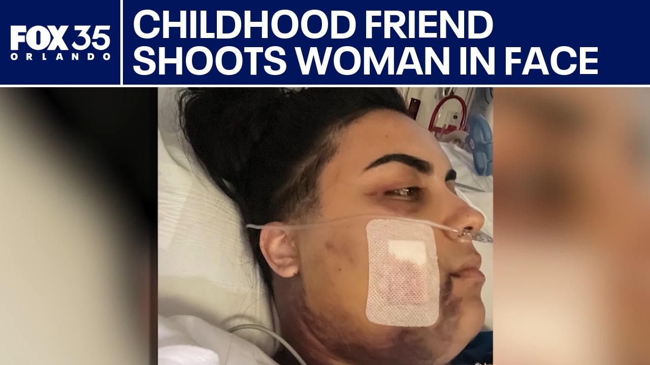 Woman shot in face by childhood friend: What happened? 