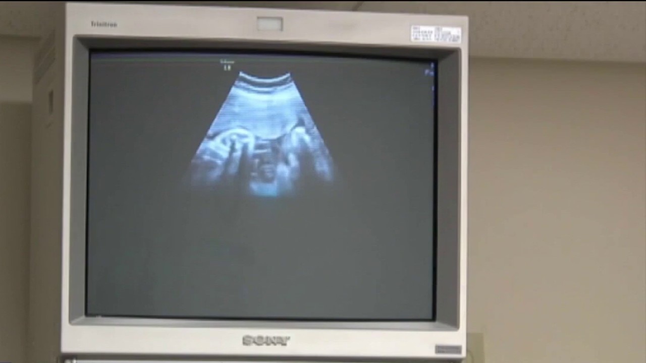 Rural maternity care crisis