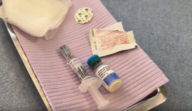 Measles case reported at St. Petersburg Catholic High School