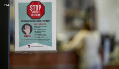 Measles cases on the rise in Florida