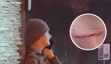 Violent, unprovoked attacks reported at 2 Florida beaches