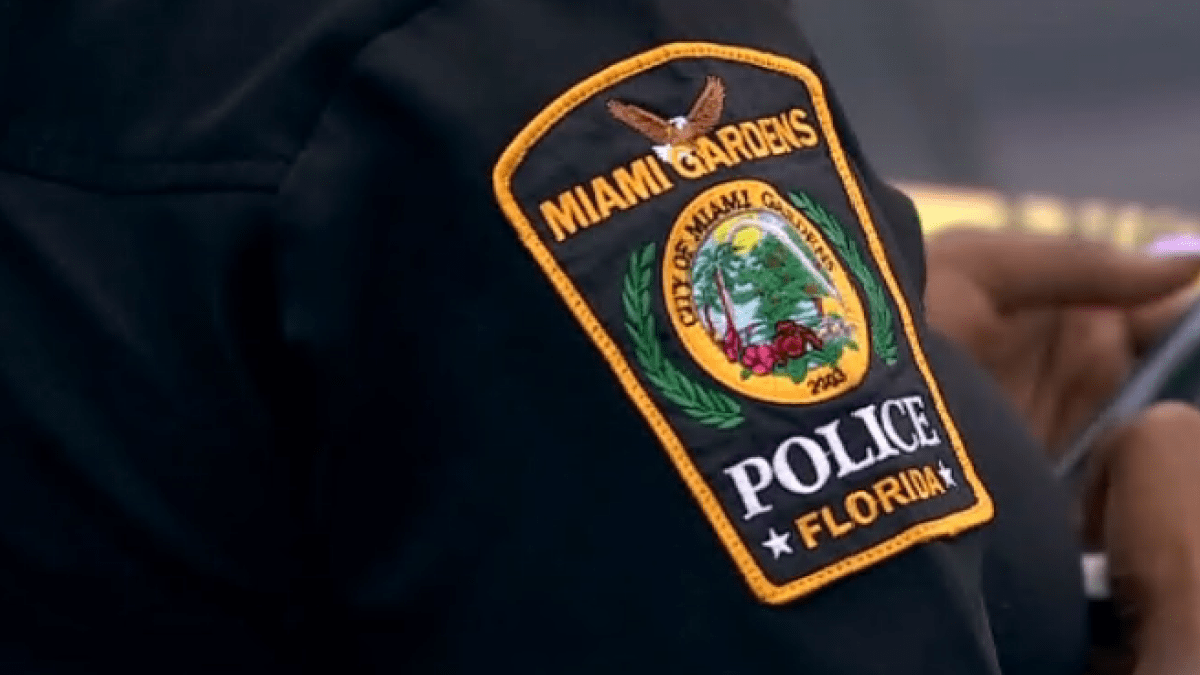 2-year-old hospitalized after being bitten in face by dogs, Miami Gardens PD says – NBC 6 South Florida